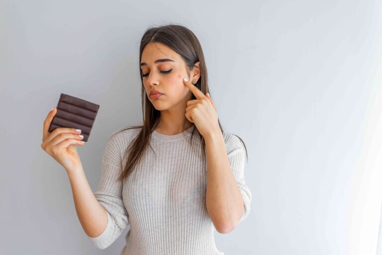 【これが原因⁉】チョコレートで肌荒れが止まらない場合の対処法は？おすすめの食べ方も紹介！